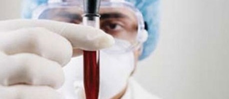 اليمن تسجّل أوّل حالة إصابة بفيروس كرونا و9 إصابات جديدة في السعوديّة