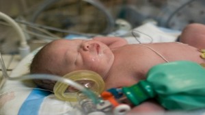 أطباء بريطانيون يجمدون مولودا ثلاثة أيام لإنقاذ حياته 