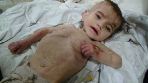 استشهاد طفل في مخيم اليرموك