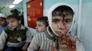 اصابة اطفال في غزة